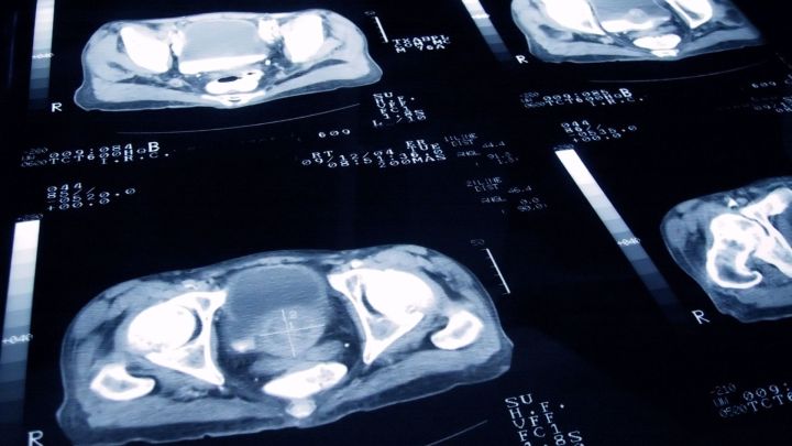 Ciberataque a Centro de Cáncer de la Universidad de Hawái expone datos de 1,2 millones de personas